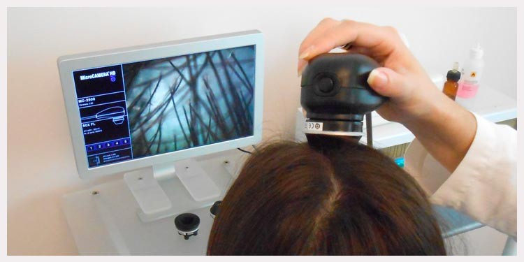 Tricología Capilar. Clínicas Capilares en Ourense y Vigo